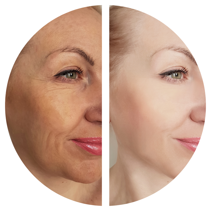 Tru Energy Skincare results in Immediate Wrinkle Reduction